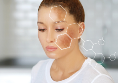 علاج التصبغات: الطرق الطبيعية والتجميلية